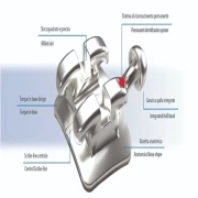 Titanium_alloy_metal_injection_molded_orthodontic_brackets_1716105324481_2.jpg_w180
